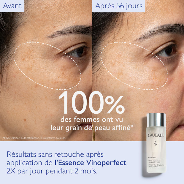 Caudalie VINOPERFECT Essence glycolique concentrée d'eclat, 100ml | Parashop.com